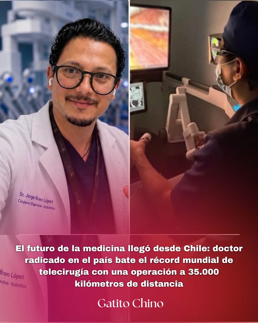 Chile hace historia en la medicina con un récord mundial de telecirugía a 35.000 km